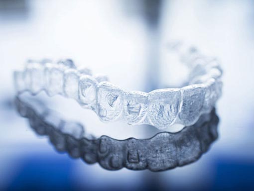 smiling woman with straight teeth